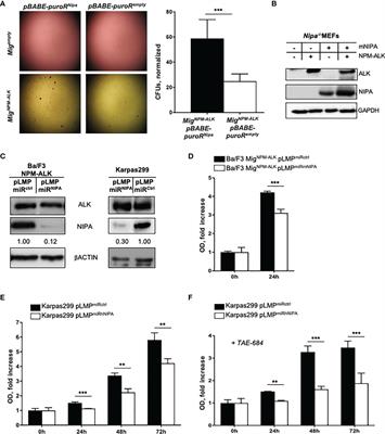 NIPA (Nuclear Interaction Partner of ALK) Is Crucial for Effective NPM-ALK Mediated Lymphomagenesis